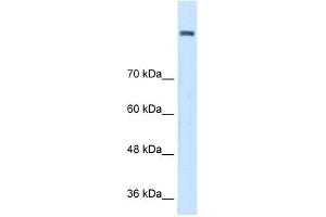 WB Suggested Anti-AOC2 Antibody Titration:  0. (AOC2 抗体  (Middle Region))