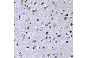Immunohistochemistry of paraffin-embedded mouse brain using SOX5 antibody (ABIN2560088) at dilution of 1:100 (40x lens). (SOX5 抗体)