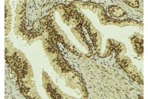 ABIN6274592 at 1/100 staining Mouse colon tissue by IHC-P.