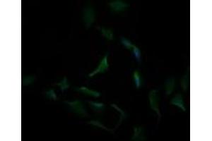 Image no. 3 for anti-Carbonic Anhydrase 12 (CA12) antibody (ABIN1497065) (CA12 抗体)