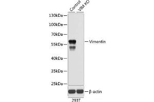 Western blot analysis of extracts from normal (control) and Vimentin knockout (KO) 293T cells using Vimentin Polyclonal Antibody at dilution of 1:1000. (Vimentin 抗体)