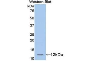 Western Blotting (WB) image for anti-Transcription Factor 20 (TCF20) (AA 125-213) antibody (ABIN1172584) (TCF20 抗体  (AA 125-213))
