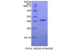 SDS-PAGE analysis of Rat ADAM10 Protein. (ADAM10 蛋白)
