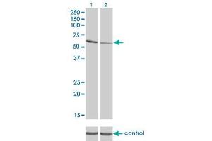 Western blot analysis of RIOK3 over-expressed 293 cell line, cotransfected with RIOK3 Validated Chimera RNAi (Lane 2) or non-transfected control (Lane 1). (RIOK3 抗体  (AA 411-516))
