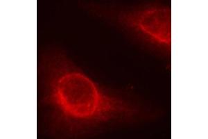 Immunofluorescence staining of methanol-fixed Hela cells, using phospho-CFL1-S3 antibody. (Cofilin 抗体  (pSer3))