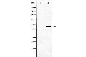 Western blot analysis of GATA1 expression in K562 whole cell lysates,The lane on the left is treated with the antigen-specific peptide. (GATA1 抗体  (Internal Region))
