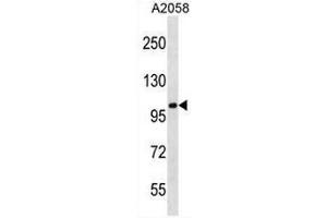 CCDC46 Antibody (N-term) western blot analysis in A2058 cell line lysates (35µg/lane). (CCDC46 抗体  (N-Term))