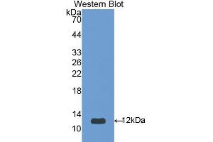 Western blot analysis of the recombinant protein. (SERPINA12 抗体  (AA 52-143))