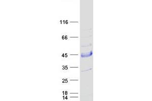 SNX21 Protein (Transcript Variant 2) (Myc-DYKDDDDK Tag)