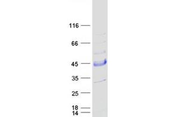 SNX21 Protein (Transcript Variant 2) (Myc-DYKDDDDK Tag)