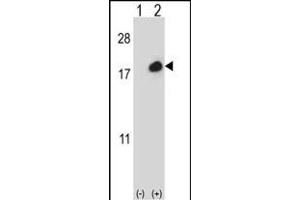 Western blot analysis of ISG15 (arrow) using rabbit polyclonal ISG15 Antibody (C-term ) (ABIN387984 and ABIN2844985). (ISG15 抗体  (C-Term))