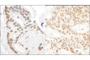 anti-DEAD (Asp-Glu-Ala-Asp) Box Polypeptide 27 (DDX27) (AA 700-750) antibody