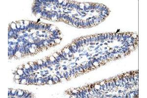 Image no. 1 for anti-Kelch-Like 13 (KLHL13) (N-Term) antibody (ABIN6736185) (KLHL13 抗体  (N-Term))