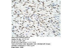 Rabbit Anti-HNRPAB Antibody  Paraffin Embedded Tissue: Human Heart Cellular Data: Myocardial cells Antibody Concentration: 4. (HNRNPAB 抗体  (C-Term))