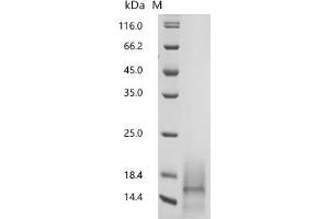 (Tris-Glycine gel) Discontinuous SDS-PAGE (reduced) with 5 % enrichment gel and 15 % separation gel.