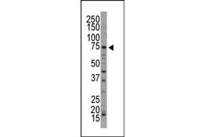 Western Blotting (WB) image for anti-NUAK Family, SNF1-Like Kinase, 1 (NUAK1) (C-Term) antibody (ABIN360528) (NUAK1 抗体  (C-Term))