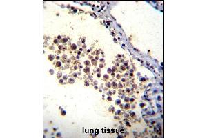 DOK3 Antibody (C-term) (ABIN655979 and ABIN2845363) immunohistochemistry analysis in formalin fixed and paraffin embedded human lung tissue followed by peroxidase conjugation of the secondary antibody and DAB staining. (DOK3 抗体  (C-Term))