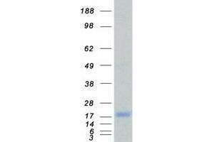 Western Blotting (WB) image for Inhibitor of DNA Binding 1, Dominant Negative Helix-Loop-Helix Protein (ID1) (Transcript Variant 1) protein (Myc-DYKDDDDK Tag) (ABIN2723225)