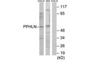 Western blot analysis of extracts from COLO/293 cells, using PPHLN Antibody. (PPHLN1 抗体  (AA 71-120))