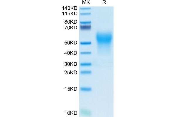 IL18BP Protein (AA 31-194) (His-Avi Tag,Biotin)