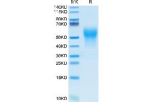 IL18BP Protein (AA 31-194) (His-Avi Tag,Biotin)