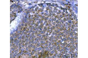 IHC analysis of MSF/SEPTIN9 using anti-MSF/SEPTIN9 antibody (ABIN7600104). (Septin 9 抗体  (AA 15-282))