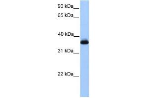 ERI2 antibody used at 1 ug/ml to detect target protein. (ERI2 抗体  (Middle Region))