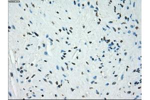 Immunohistochemical staining of paraffin-embedded endometrium tissue using anti-KDM4C mouse monoclonal antibody. (KDM4C 抗体)
