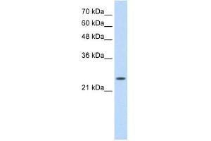 Troponin I Type 1 antibody used at 0. (TNNI1 抗体)