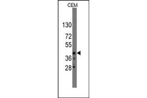 Image no. 1 for anti-Protein Quaking (QKI) (N-Term) antibody (ABIN357831) (QKI 抗体  (N-Term))