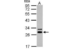 WB Image Sample (30 ug of whole cell lysate) A: A431 12% SDS PAGE antibody diluted at 1:5000 (DCK 抗体  (Center))