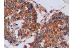Immunohistochemistry (IHC) image for anti-Carbonic Anhydrase IX (CA9) (AA 59-414) antibody (ABIN7437167)