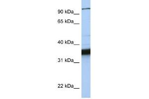 KIFC3 antibody used at 1 ug/ml to detect target protein. (KIFC3 抗体  (C-Term))