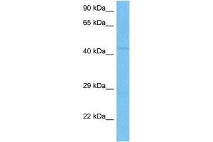 Western Blotting (WB) image for anti-Nuclear Receptor Subfamily 1, Group H, Member 3 (NR1H3) (C-Term) antibody (ABIN2780709)