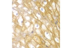 Immunohistochemistry (Paraffin-embedded Sections) (IHC (p)) image for anti-Actinin, alpha 1 (ACTN1) (AA 1-330) antibody (ABIN3021587)