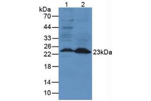 Figure. (Lipocalin 2 抗体  (AA 21-200))