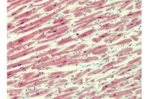 Human Heart: Formalin-Fixed, Paraffin-Embedded (FFPE) (IRAK4 抗体  (N-Term))