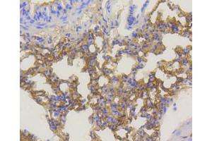 Paraformaldehyde-fixed, paraffin embedded mouse lung section, Antigen retrieval by boiling in sodium citrate buffer (pH6) for 15min, Block endogenous peroxidase by 3% hydrogen peroxide for 30 minutes, Blocking buffer (normal goat serum) at 37°C for 20min, Antibody incubation with Akt1(Ser473) (12A1) Monoclonal Antibody  at 1:400 overnight at 4°C, followed by a conjugated secondary and DAB staining.