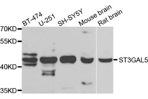 Western blot analysis of extracts of various cell lines, using ST3GAL5 antibody. (ST3GAL5 抗体)