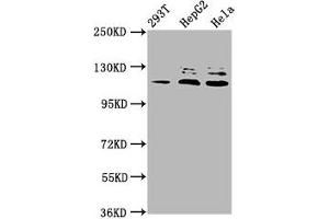 Western Blot Positive WB detected in: 293T whole cell lysate, HepG2 whole cell lysate, Hela whole cell lysate All lanes: MAP3K21 antibody at 3. (MLK4 抗体  (AA 640-794))