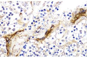 Immunohistochemistry of paraffin-embedded Human tonsil using BMPR1B Polyclonal Antibody at dilution of 1:200 (40x lens). (BMPR1B 抗体)