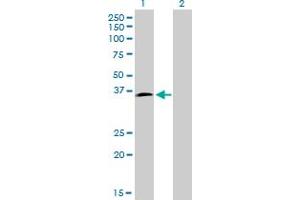 Western Blot analysis of HOXD8 expression in transfected 293T cell line by HOXD8 monoclonal antibody (M01), clone 10F8. (HOXD8 抗体  (AA 126-190))