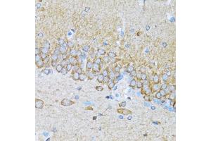 Immunohistochemistry of paraffin-embedded mouse brain using MAP1LC3B antibody (ABIN5973262) at dilution of 1/100 (40x lens).
