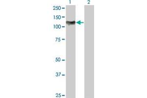 Western Blotting (WB) image for anti-Nuclear Factor of kappa Light Polypeptide Gene Enhancer in B-Cells 1 (NFKB1) (AA 860-969) antibody (ABIN561981)