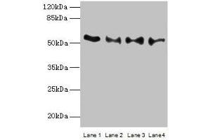 Western blot All lanes: TRIM15 antibody at 2 μg/mL Lane 1: Jurkat whole cell lysate Lane 2: Hela whole cell lysate Lane 3: HepG2 whole cell lysate Lane 4: A549 whole cell lysate Secondary Goat polyclonal to rabbit IgG at 1/10000 dilution Predicted band size: 53, 13 kDa Observed band size: 53 kDa (TRIM15 抗体  (AA 122-387))