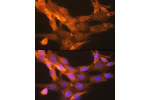Immunofluorescence analysis of NIH-3T3 cells using tPA/tPA/PLAT Rabbit mAb (ABIN1678727, ABIN3018699, ABIN3018700 and ABIN7101650) at dilution of 1:100 (40x lens). (PLAT 抗体)