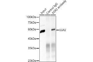Immunoprecipitation analysis of 600 μg extracts of Mouse brain cells using 3 μg EGR2 antibody (ABIN1682321, ABIN7101509, ABIN7101510 and ABIN7101511). (EGR2 抗体)