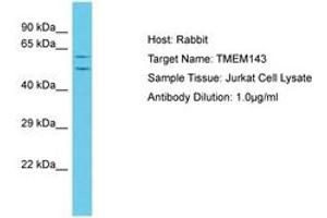 Image no. 1 for anti-Transmembrane Protein 143 (TMEM143) (C-Term) antibody (ABIN6750626) (TMEM143 抗体  (C-Term))