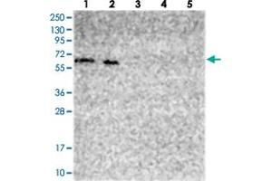 Western blot analysis of Lane 1: RT-4, Lane 2: U-251 MG, Lane 3: Human Plasma, Lane 4: Liver, Lane 5: Tonsil with PHF8 polyclonal antibody . (PHF8 抗体)