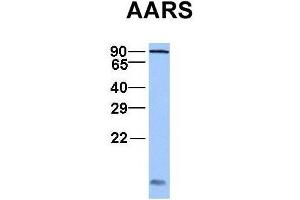 Host:  Rabbit  Target Name:  AARS  Sample Type:  Jurkat  Antibody Dilution:  1. (AARS 抗体  (C-Term))